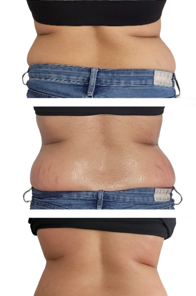 Body Contour & Spa