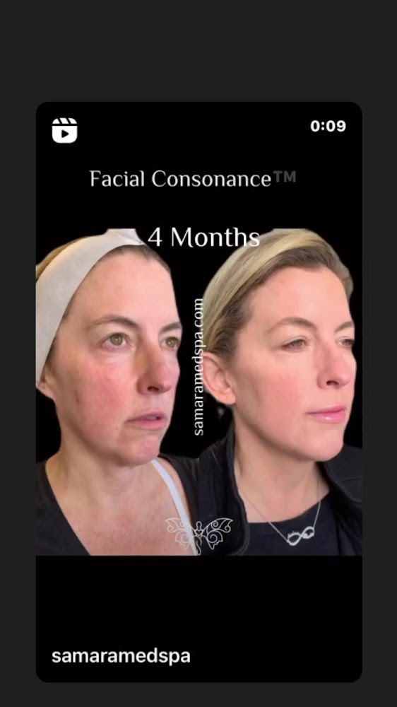 Samara MedSpa Avon