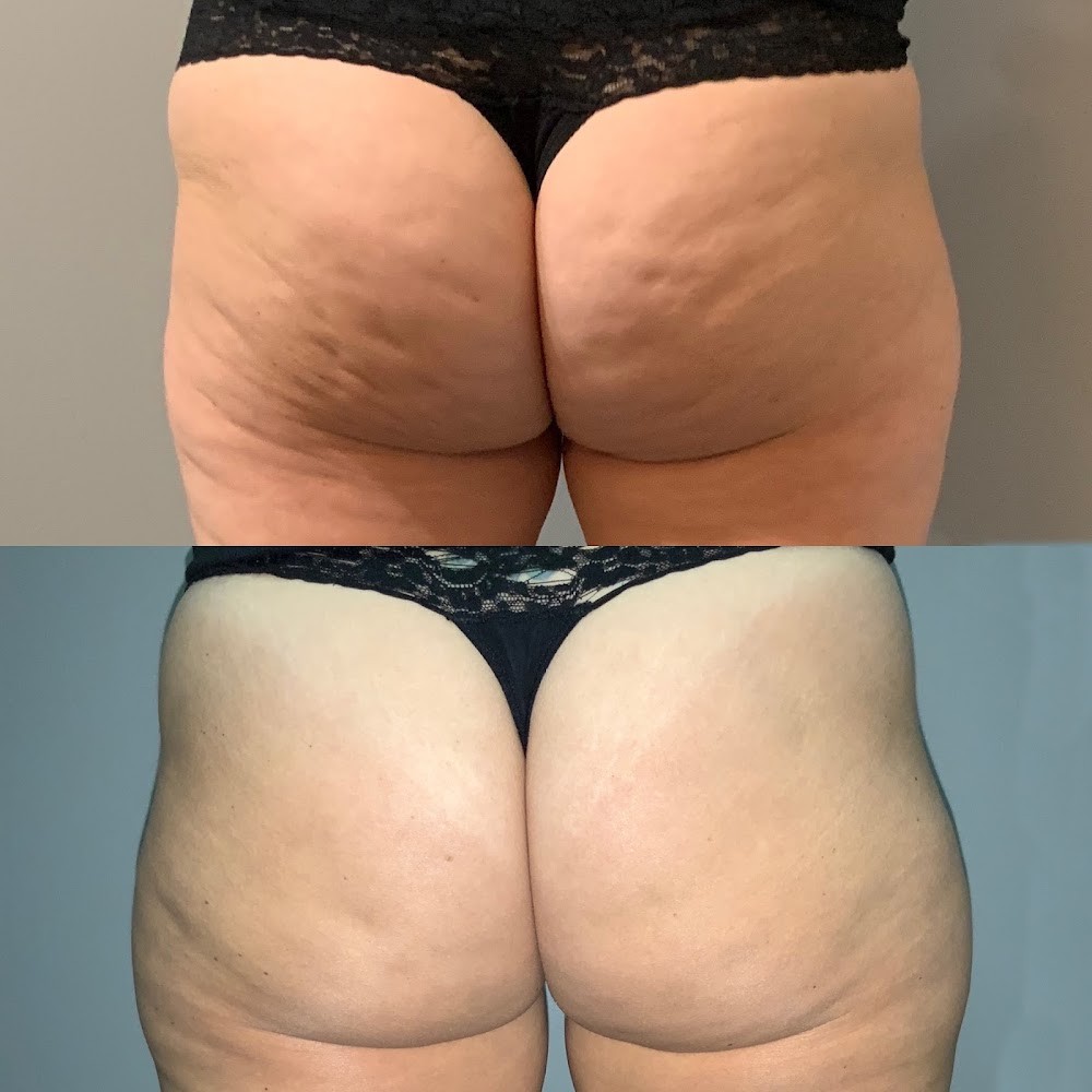 Pure Skin MedSpa of Trumbull