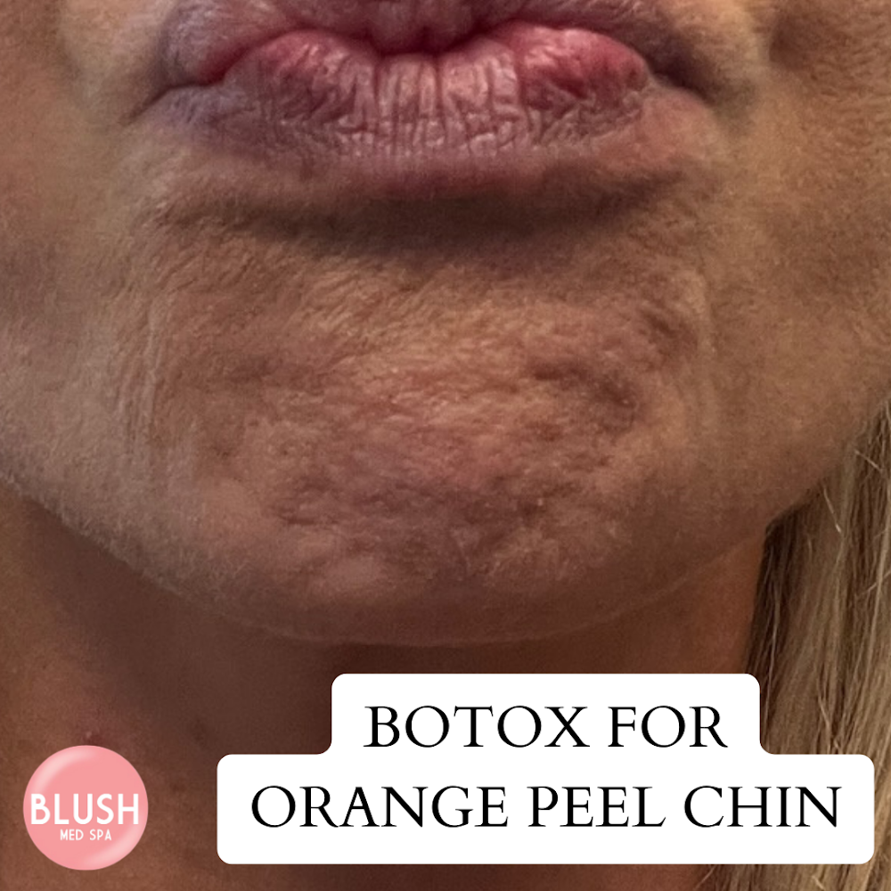 Blush Med Spa