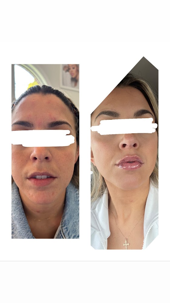 Alia Aesthetics Medical Spa -Filler, Botox, Nails, Waxing, Facials