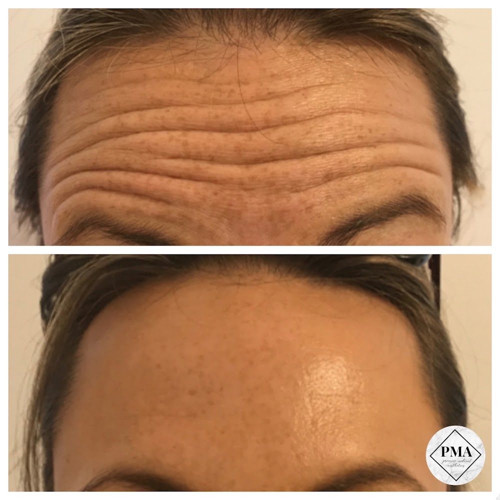 Premier Medical Aesthetics